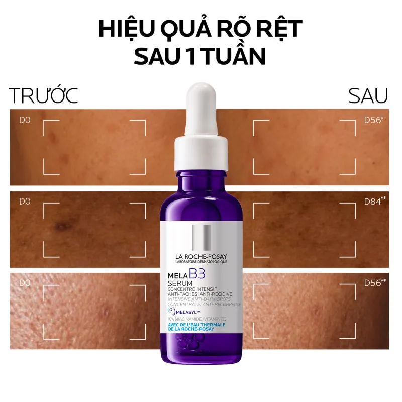 Laroche Posay Mela B3 Serum Giúp Mờ Thâm Nám Và Sáng Da 30ml