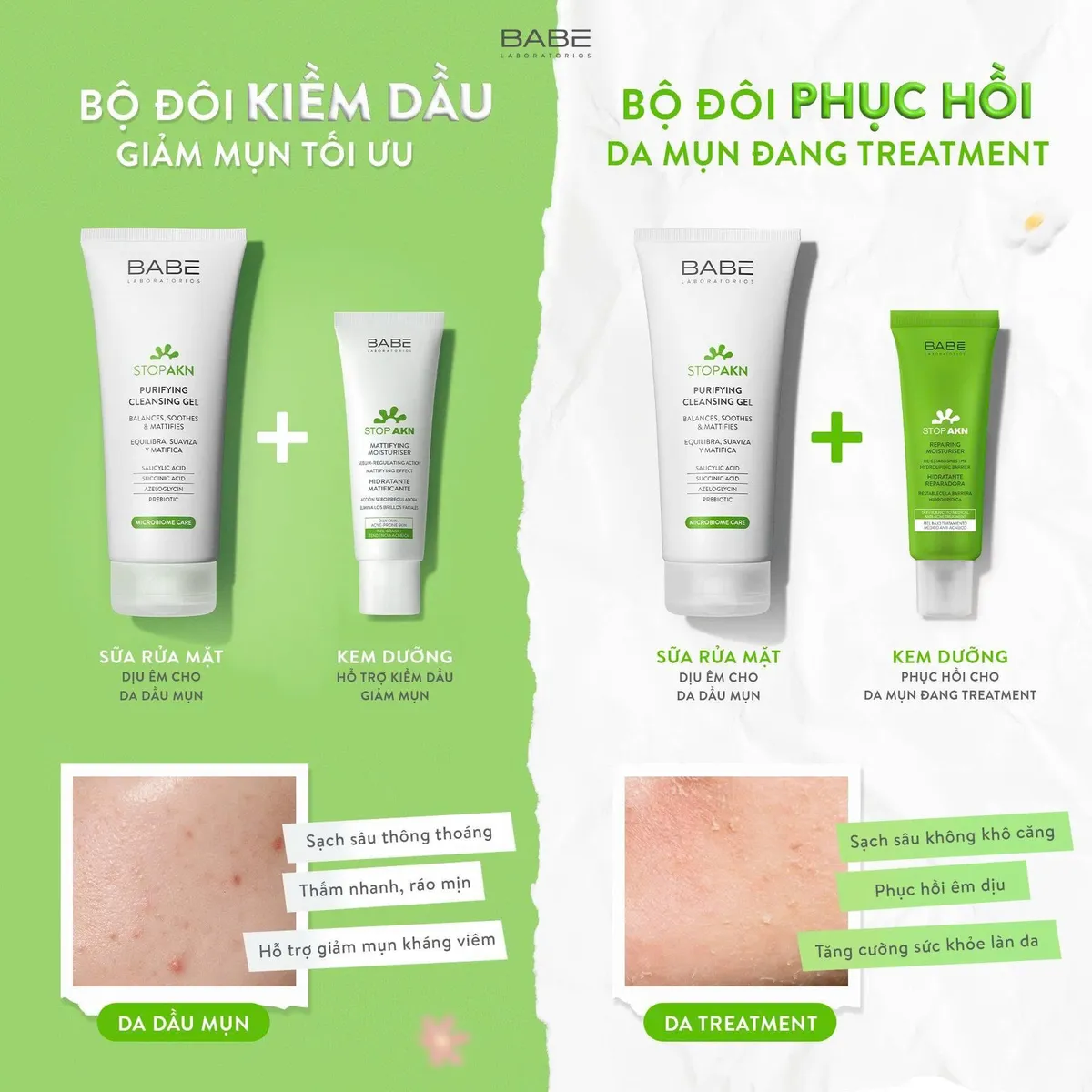 Sữa rửa mặt BABE Stop Akn Purifying Cleansing Gel 200ml