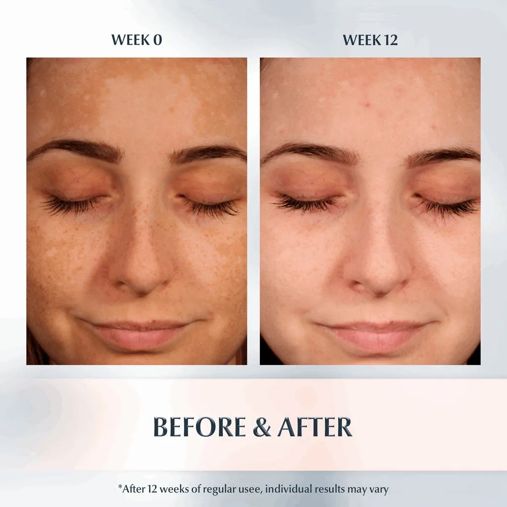 Tinh Chất Chống Nắng EUCERIN Spotless Brightening Serum Spf50+ Giúp Dưỡng Trắng Da